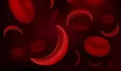 Perempuan Rawan Terkena Anemia, Begini Cara Pencegahannya Sejak Dini